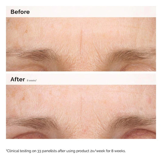 The Ordinary
Retinal 0.2% Emulsion Serum Size:15 ml