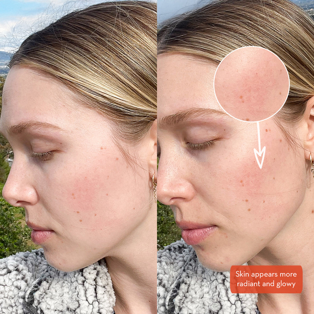 SONÄGE Lumenez Vitamin Rich Creme®
Vitamin C & E Moisturizer | Advanced Skin