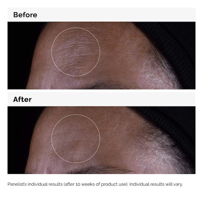 The Ordinary
GF 15% Serum for Visible Skin Repair and Wrinkles Size:30mL