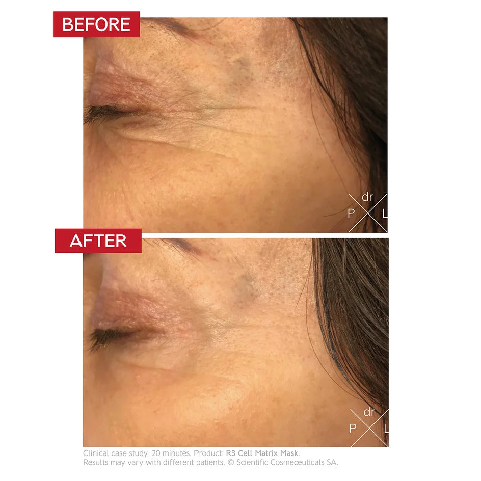 Dr LEVY Switzerland
R3 Cell Matrix Mask Size:50 ml