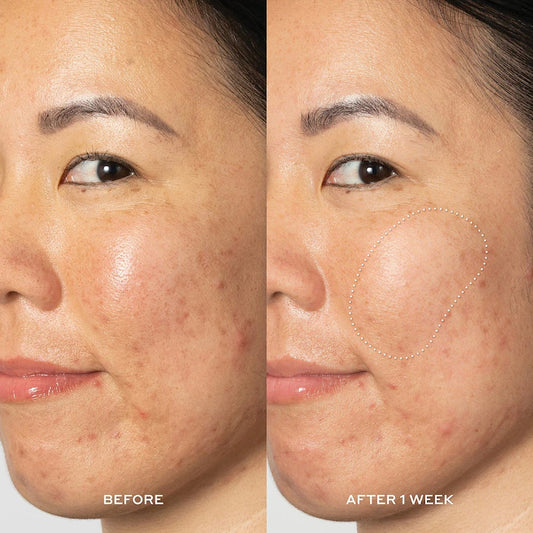 OLEHENRIKSEN
Glow2OH 7% AHA Exfoliating Dark Spot Toner Size: 6.5 oz/ 190 mL