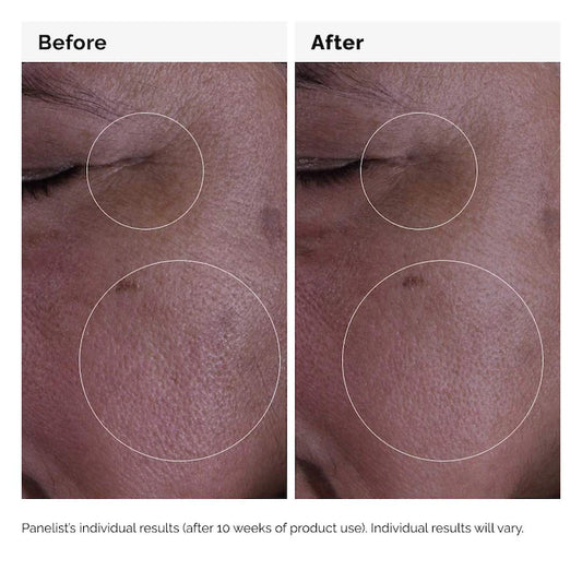 The Ordinary
GF 15% Serum for Visible Skin Repair and Wrinkles Size:30mL