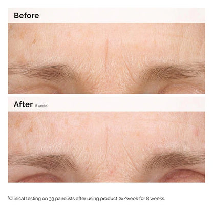 The Ordinary 
Retinal 0.2% Emulsion Serum Size:15 ml