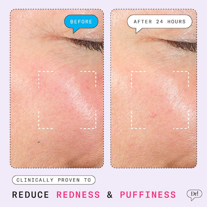 Dr. Idriss 
The Depuffer Redness Reducing + Depuffing Roll-On Serum