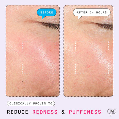 Dr. Idriss 
The Depuffer Redness Reducing + Depuffing Roll-On Serum