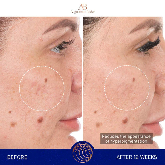 Augustinus Bader 
The Retinol Serum Size:15ml