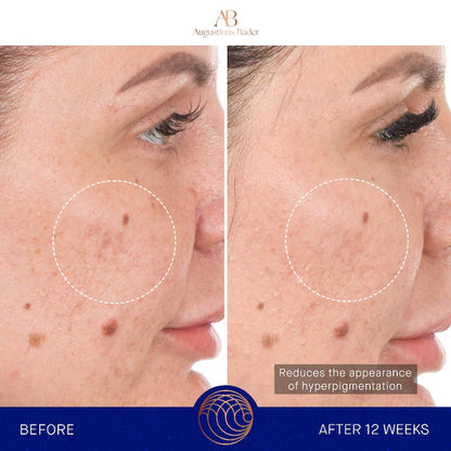 Augustinus Bader 
The Retinol Serum Size:15ml