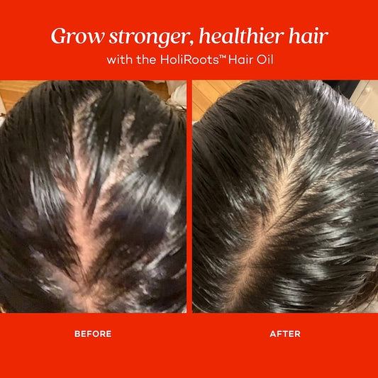 Fable & Mane HoliRoots™ Pre-Wash Treatment Oil for Thinning Hair Size:0.48 oz/ 14.4 mL