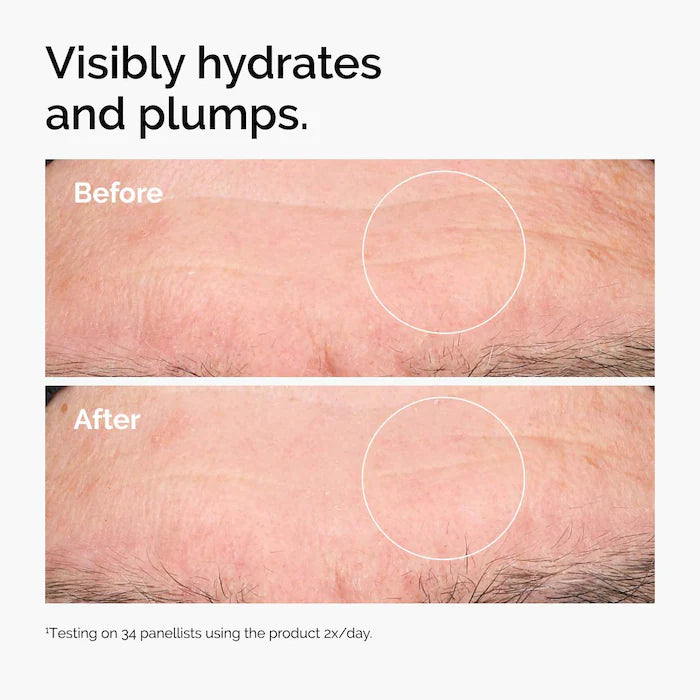 The Ordinary 
Hyaluronic Acid 2% + B5 Hydrating Serum with Ceramides		Size: 1 oz / 30 ml