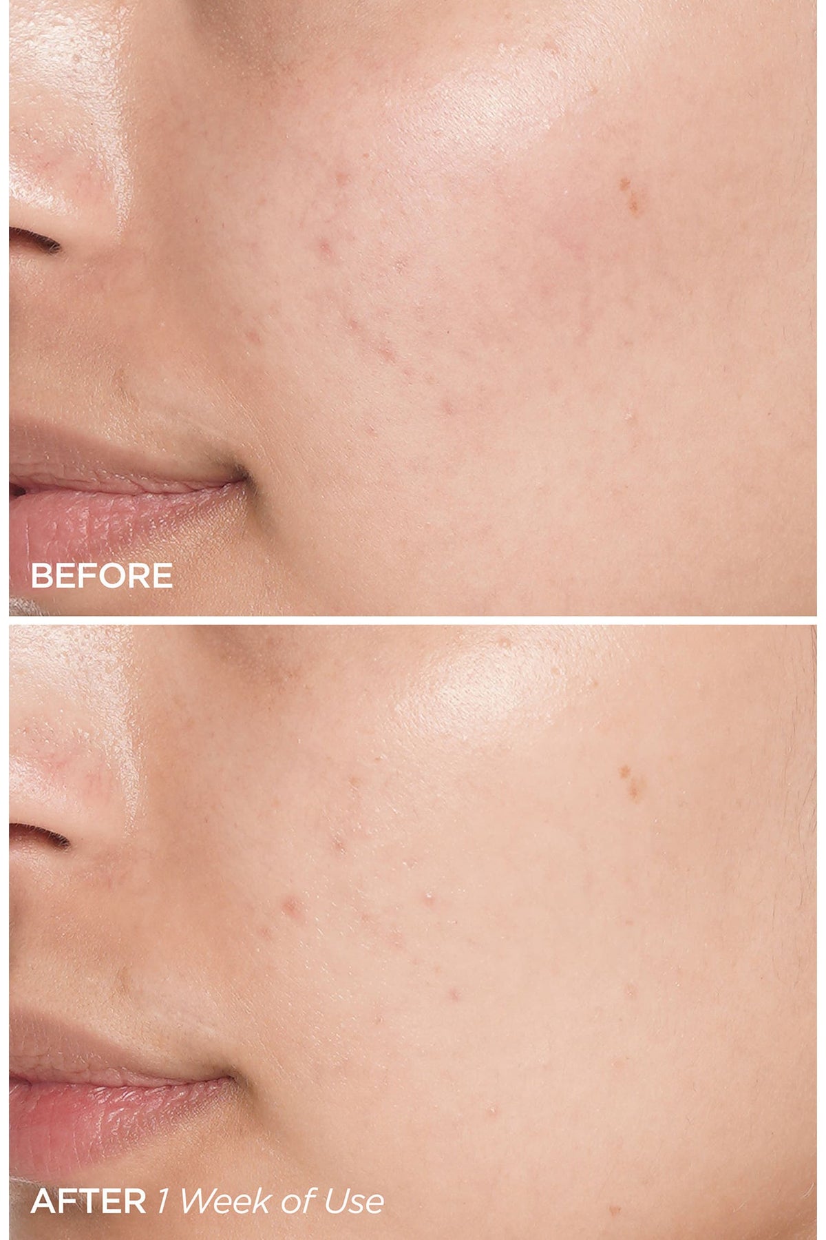 BEAUTYBIO Swipe & Glow Peel Pads