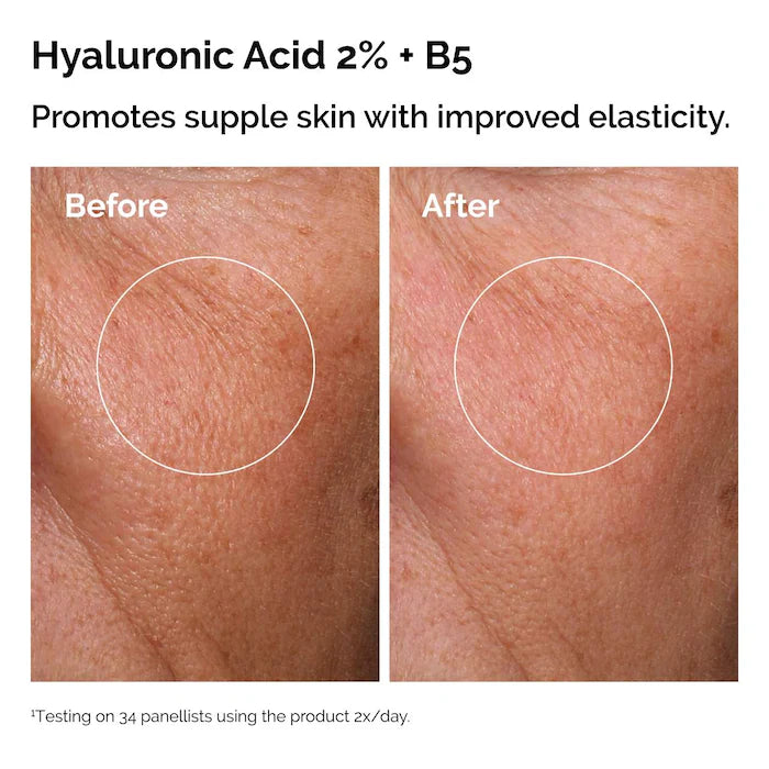 The Ordinary 
The Skin Support Set with Niacinamide + Hyaluronic Acid
