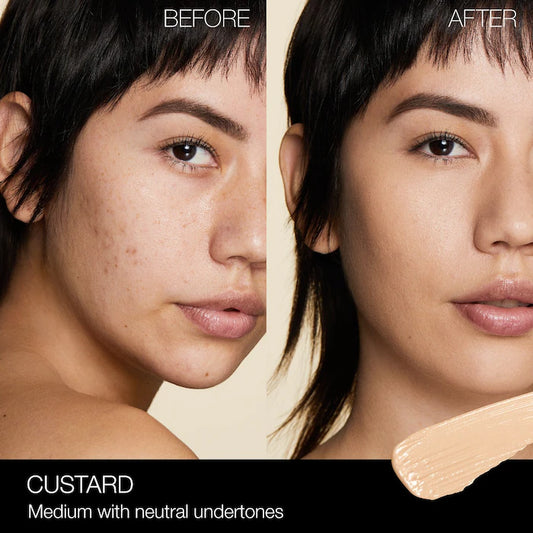 NARS 
Radiant Creamy Concealer with Medium Coverage Color: Custard - M1 - medium with neutral undertones