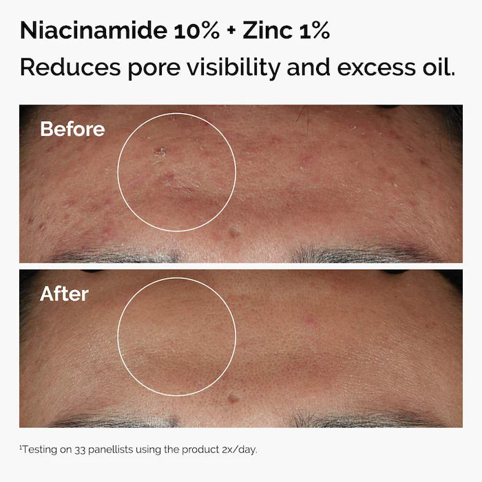The Ordinary 
The Skin Support Set with Niacinamide + Hyaluronic Acid
