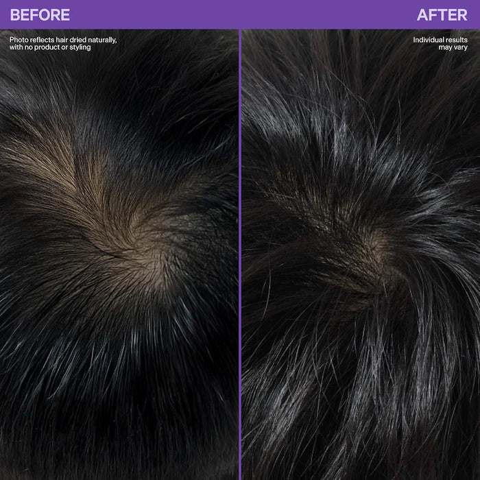 Dr. Groot 
Roll-On Hair Thickening Scalp Serum for Thinning Hair Size:15 ml
