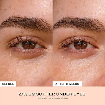 OLEHENRIKSEN 
Banana Bright+ Vitamin C Eye Crème for Dark Circles Size: 0.5 oz / 15 mL