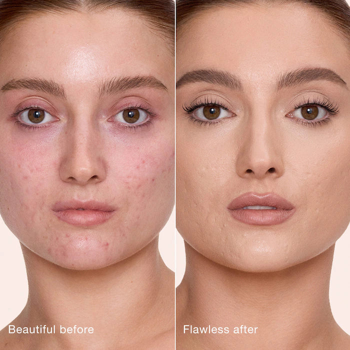 Charlotte Tilbury 
Airbrush Flawless Crease-Proof Long-Wear Blur Concealer with Hyaluronic Acid Color: 5 Medium - Medium with cool undertones