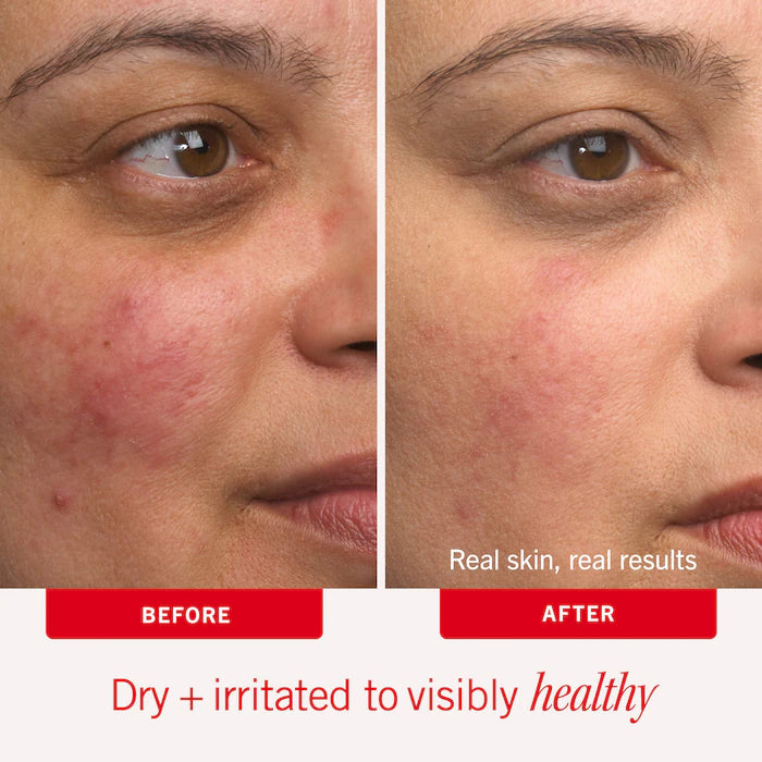 First Aid Beauty 
Ultra Repair® Cream Intense Hydration – Face and Body Moisturizer for Skin Repair Size:170.1 mL