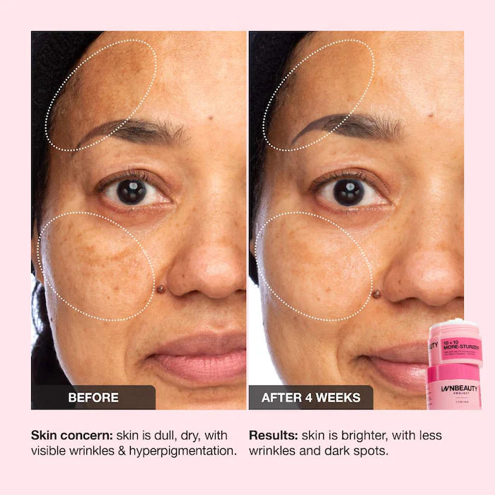 INNBEAUTY PROJECT 
10 + 10 Moisturizer with 10% Vitamin C + 10% Peptide Complex + Ceramides Size:50ml
