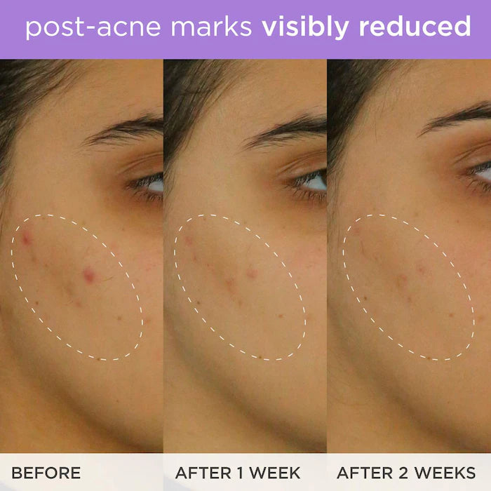 Tatcha 
Brightening & Firming Vitamin-C Serum with Ferulic Acid Size:30 ml