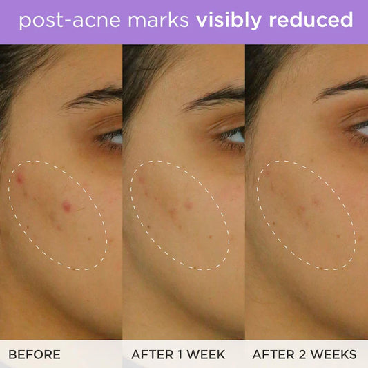 Tatcha 
Brightening & Firming Vitamin-C Serum with Ferulic Acid Size:30 ml