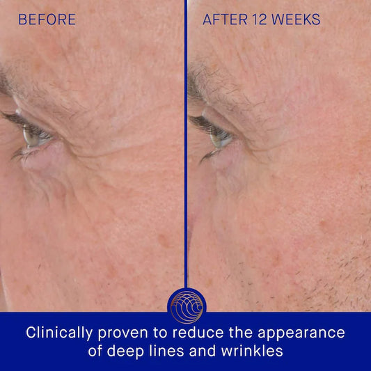 Augustinus Bader 
The Retinol Serum Size:15ml