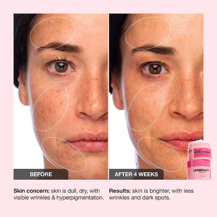 INNBEAUTY PROJECT 
10 + 10 Moisturizer with 10% Vitamin C + 10% Peptide Complex + Ceramides Size:50ml