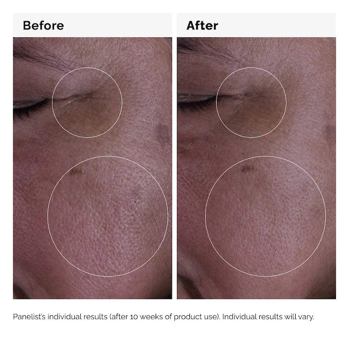 The Ordinary 
GF 15% Serum for Visible Skin Repair and Wrinkles Size:30mL